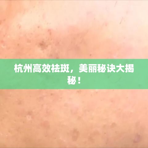 杭州高效祛斑，美麗秘訣大揭秘！