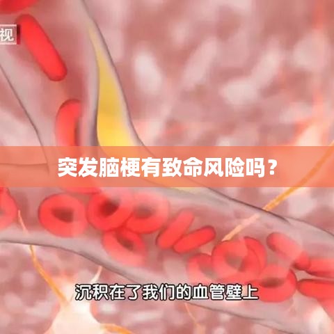 突發(fā)腦梗有致命風(fēng)險嗎？