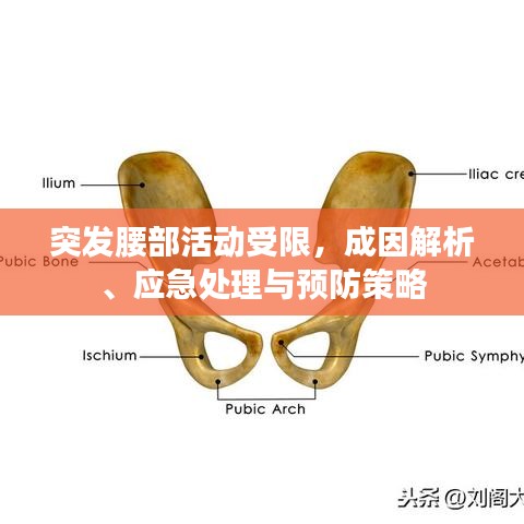 突發(fā)腰部活動受限，成因解析、應急處理與預防策略