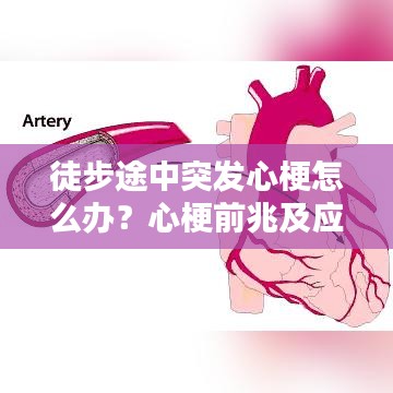 徒步途中突發(fā)心梗怎么辦？心梗前兆及應(yīng)對措施科普！
