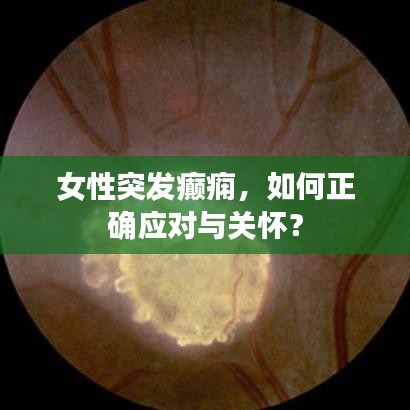 女性突發(fā)癲癇，如何正確應(yīng)對與關(guān)懷？