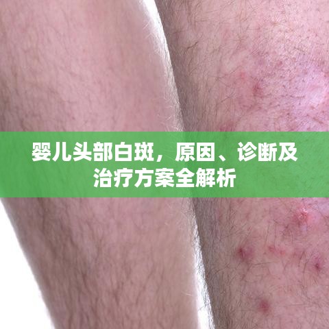 嬰兒頭部白斑，原因、診斷及治療方案全解析