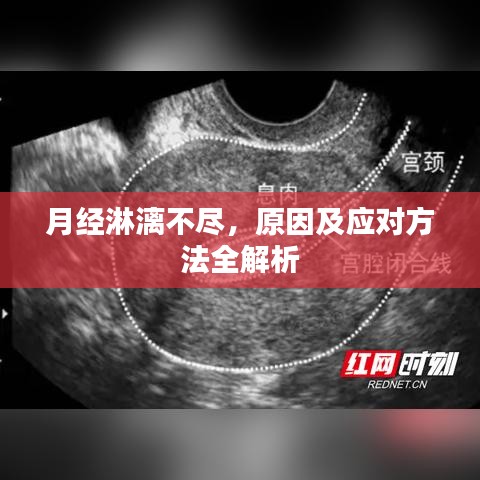 月經(jīng)淋漓不盡，原因及應(yīng)對方法全解析