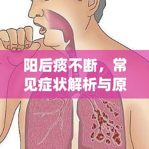 陽后痰不斷，常見癥狀解析與原因探究